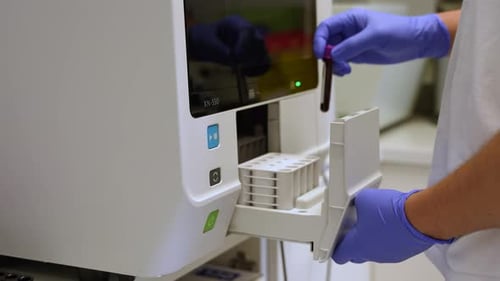 Blood Test Tubes Analyzed by Lab Technician
