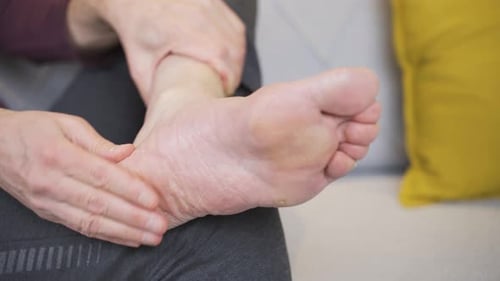 Foot close-up with fungus and cracks appearing.