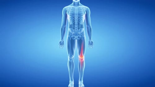 Human knee joint showing painful inflammation in a digital animation