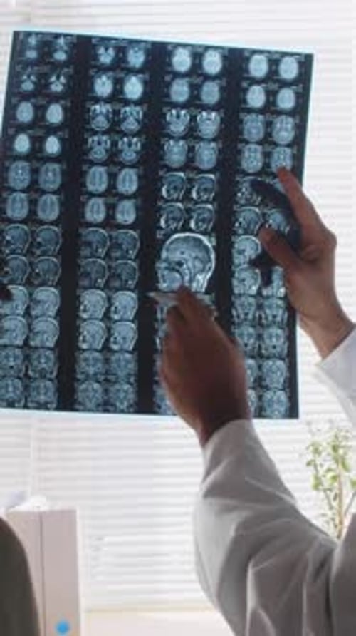 Asian Male Neurologist Consulting Patient on Brain CT Scan in Clinic