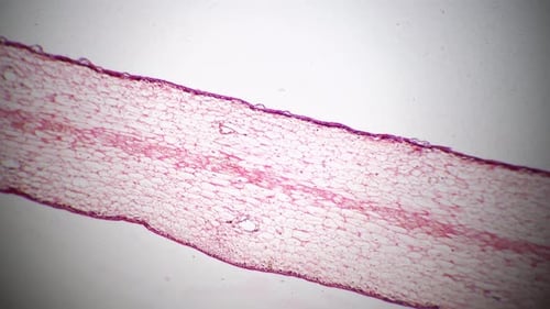 Polliondium de Funaria en coupe longitudinale au microscope 40x contre fond clair