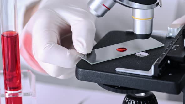 Scientist researching blood sample under microscope in laboratory ...