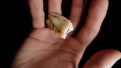 Knocked-out tooth in blood falls onto the man's hand, macro slow motion.