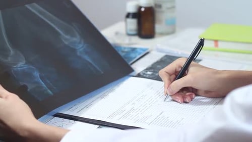 Woman Doctor Working With X Rays Of Bones In The Office