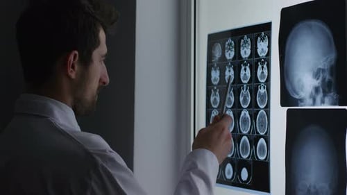 Doctor analyzing multiple brain scan images displayed on a lightbox