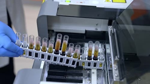 Placing the sets of test tubes into the modern apparatus. Close up. Laboratory science analysis