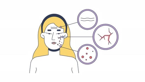 Blonde woman skin problems face diagram 2D animation