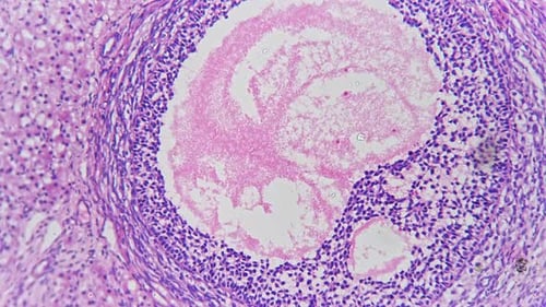 Ovary in Section Magnified Under Light Micrograph 100x Against Bright Field