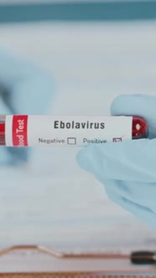Blood Sample Tests Positive for Ebola Virus