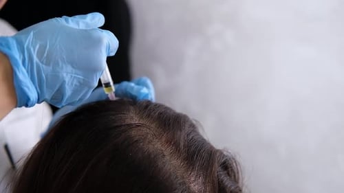 Hair Mesotherapy Treatment at Clinic, Close Up
