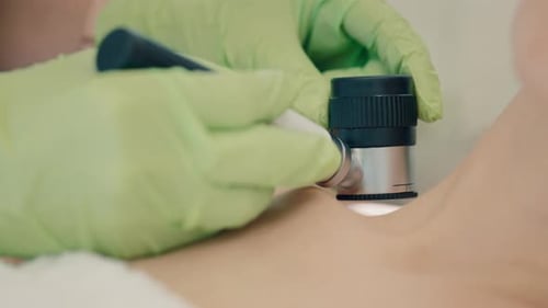 A Dermatologist Examines Moles on the Neck of a Patient Up Close Using a Dermatoscope This Medical