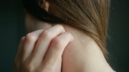 Woman Scratching Itchy Skin on Neck