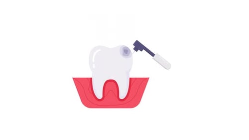 Animation alpha de l'élément de perçage à dents