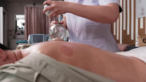 Physical therapist treats patients' back with cupping therapy at wellness spa.
