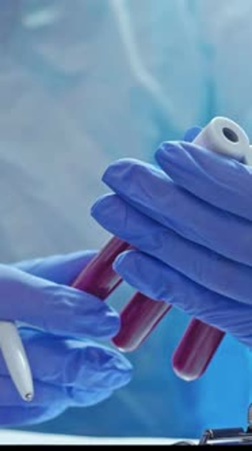 Medical Worker Hands Holding Blood Sample Test Tubes