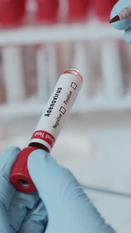 Marking Adenovirus Positive Blood Sample in Lab