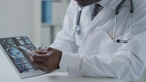 Arzt zeigt dem Patienten eine beschädigte Gehirnregion auf einer MRT-Untersuchung