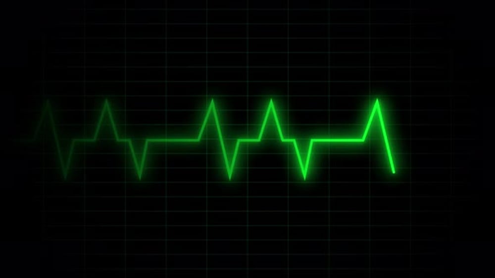 Glowing Green Heartbeat Pulse Animation on Dark Grid Background ...