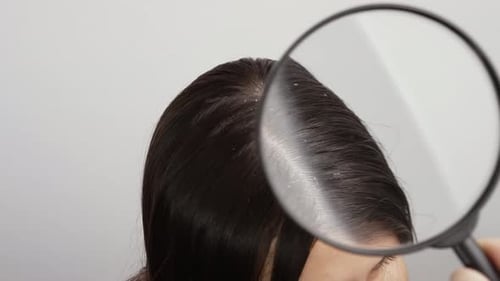 Examining Hair Dandruff with Magnifying Glass, Close Up
