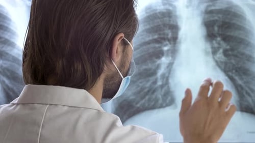 Doctor Examines X-Ray in Medical Setting
