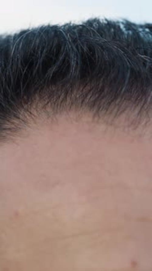Hair Of A Man With Starting Baldness