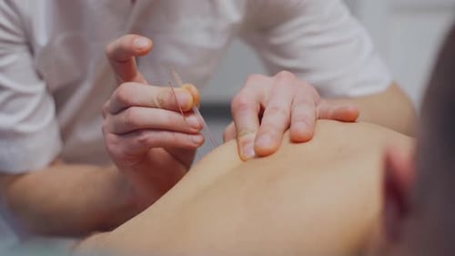 Alternative Medizin: Ein Arzt steckt einem Mann zur Akupunktur Nadeln in den Rücken