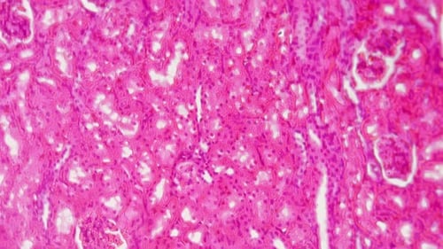 Vibrant Pink Tissue Sample Under Microscope