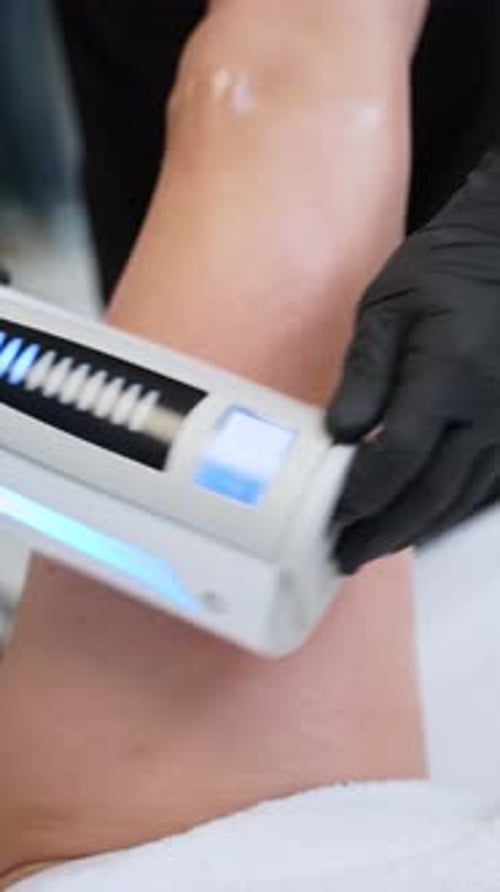 Woman Receives Leg Treatment at Medical Spa