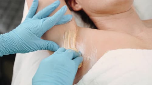 Hair Removal Specialist Makes a Procedure in a Spa Studio Sugar Hair Removal