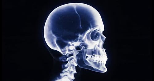 Dynamic Translucent Skull Scan Rotating Against Black Backdrop For Medical Visual
