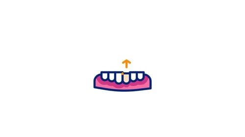 Toothextraction Animated Icon