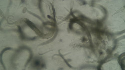 Live Microscopic Worms Movement in Liquid Under Microscope