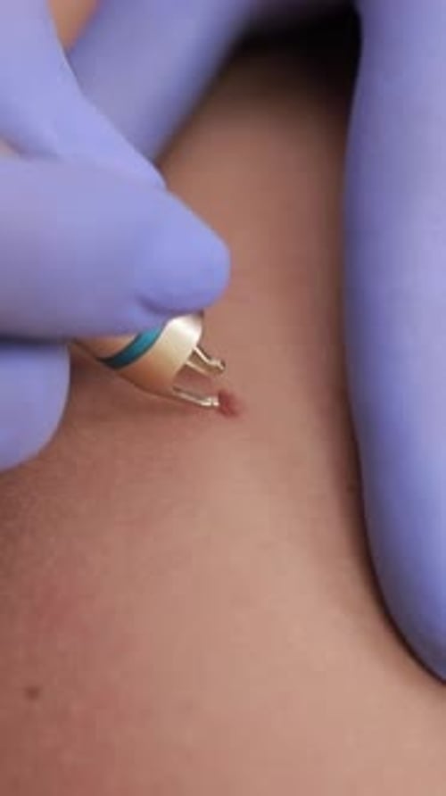 Medical Procedure Executed with Precision