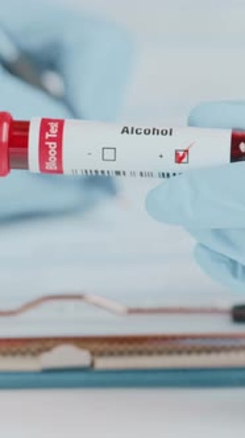 Doctor Shows Positive Alcohol Blood Test Results in Clinic