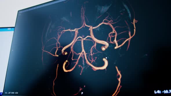 the patient undergoes computer tomography in the clinic, the ...