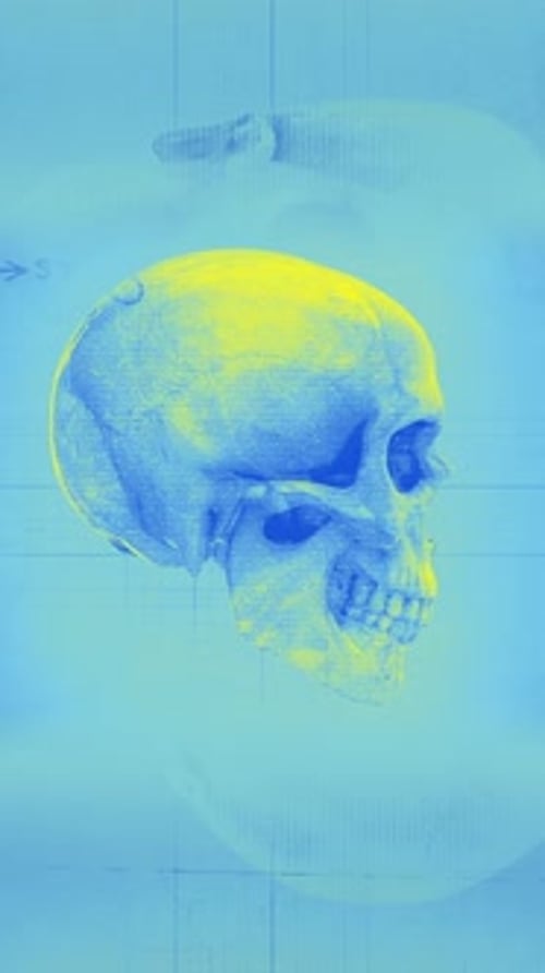 Medical Chart Skull 02