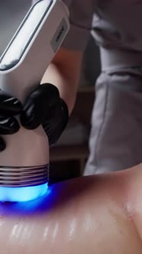 Technician Uses Aesthetic Device with Blue Light