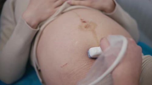 Primer plano del vientre de una mujer embarazada durante un proceso de ecografía de un médico de ultrasonografía