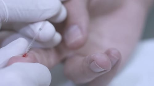 Blood Sample Collection for Medical Analysis, Close Up