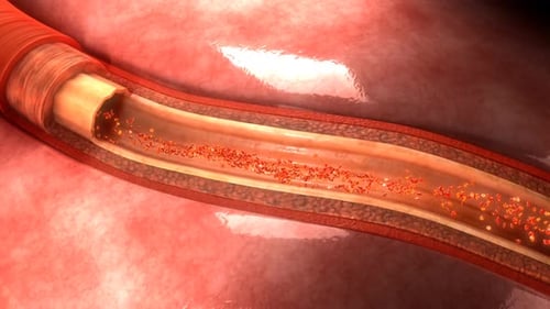 Human artery showing blood flow through vessel walls