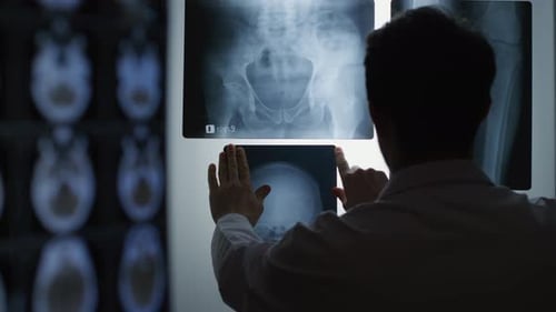 A doctor examines X-ray images in a medical setting