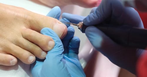 Pedicure Treatment Using Nail File