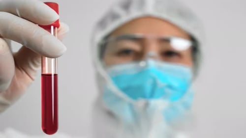 Medical Professional Holds Blood Sample in Test Tube