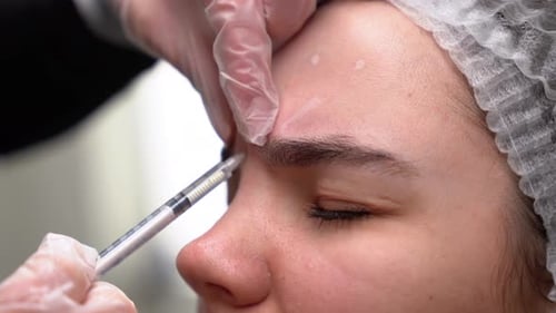 Beautician Doctor Makes Botox Injection in the Forehead of Young Beautiful Woman Extreme Close Up