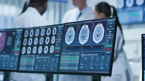 Computer Screen Showing MRI, CT Image Scan of the Brain. In the Background Meeting of the Team of