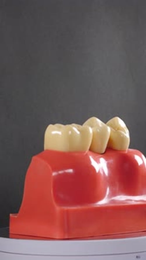 Dental Implant Model Rotating for Healthcare Information