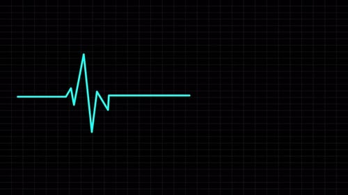 Animation zur Kardiographenaufnahme