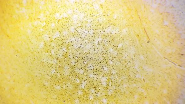 Human Silvering Cerebrum Filmed Under Microscope with 40 Times ...