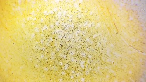 Human Silvering Cerebrum Filmed Under Microscope with 40 Times Magnification