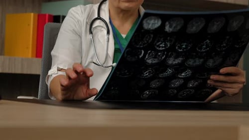 Doctor Examines Brain Scan in Hospital Office